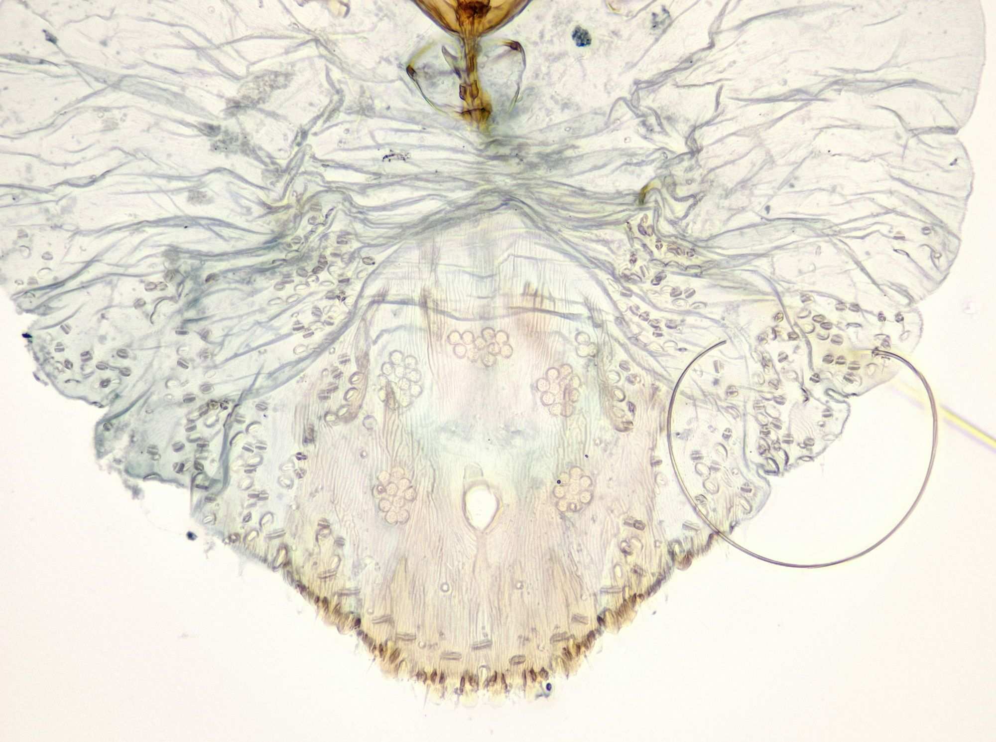 Carulaspis juniperi