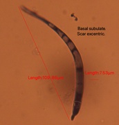 Mycocentrospora acerina