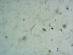 Mycocentrospora acerina