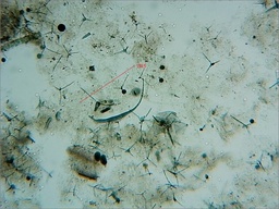Mycocentrospora acerina