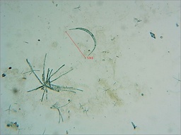 Mycocentrospora acerina