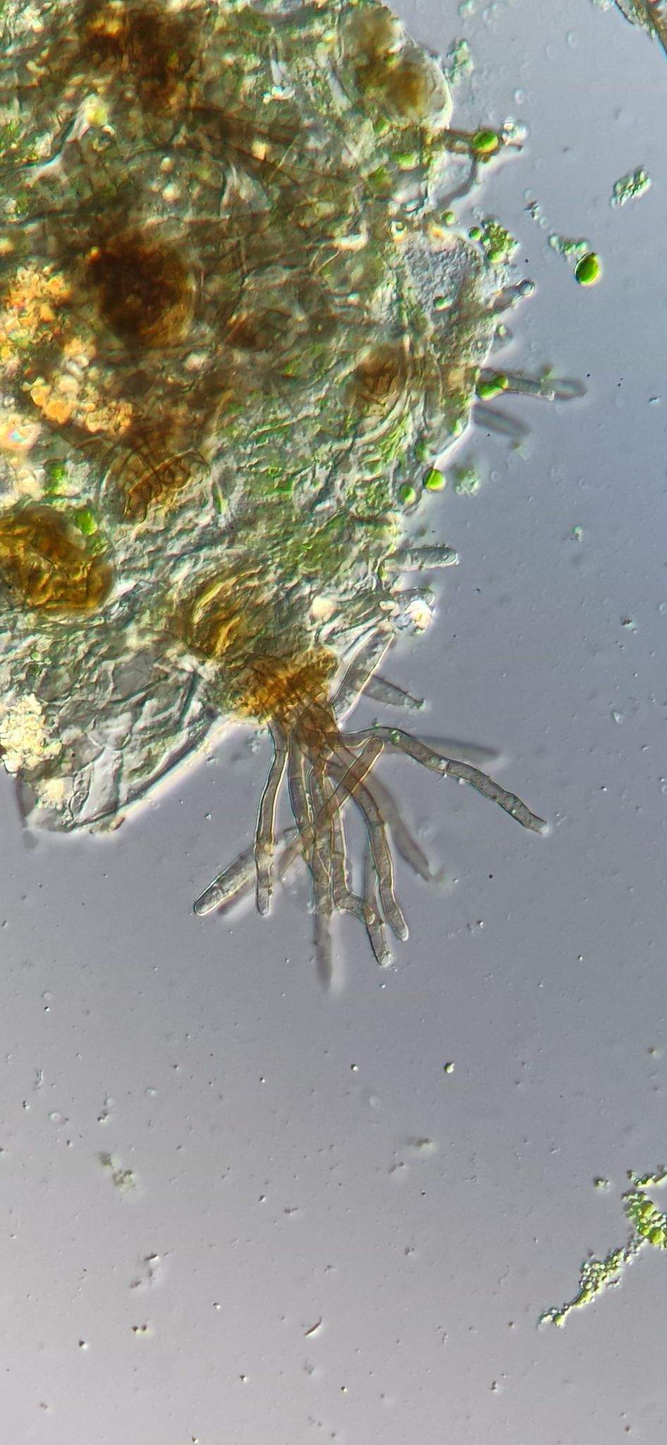 Pseudocercospora abelmoschi