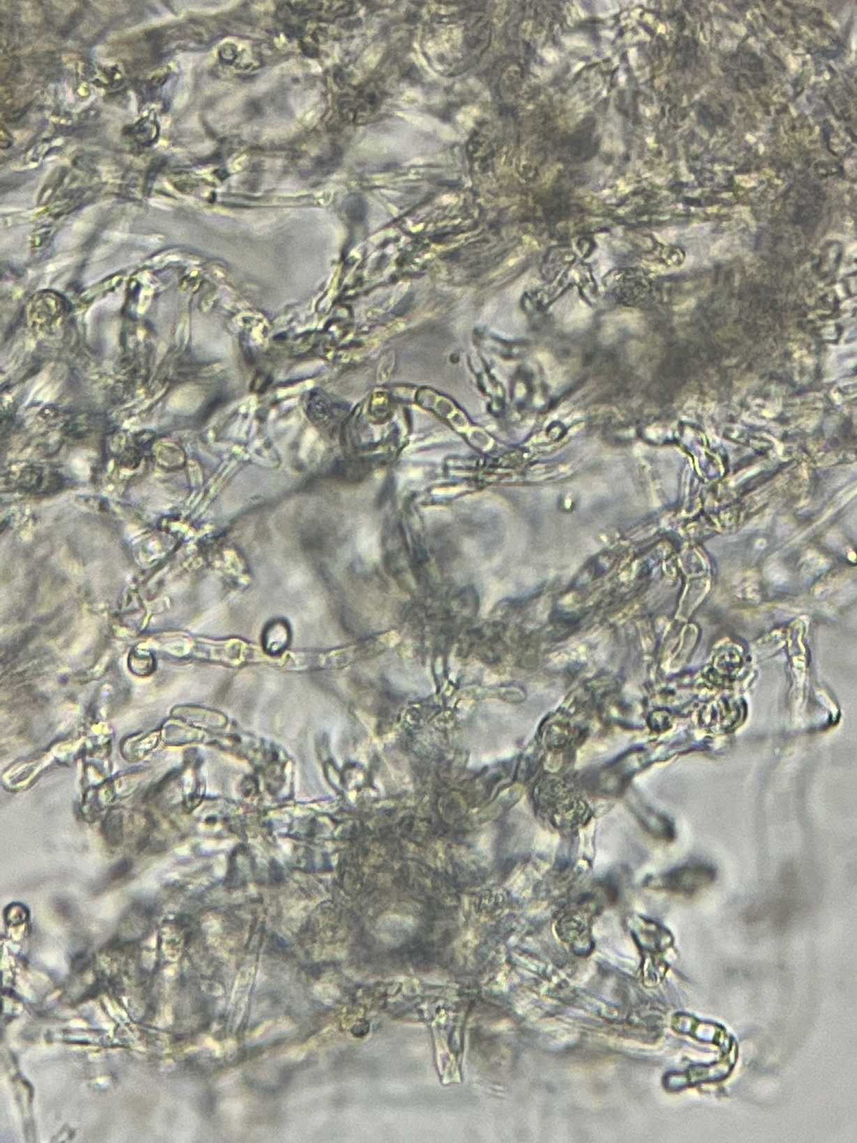 Fusarium incarnatum