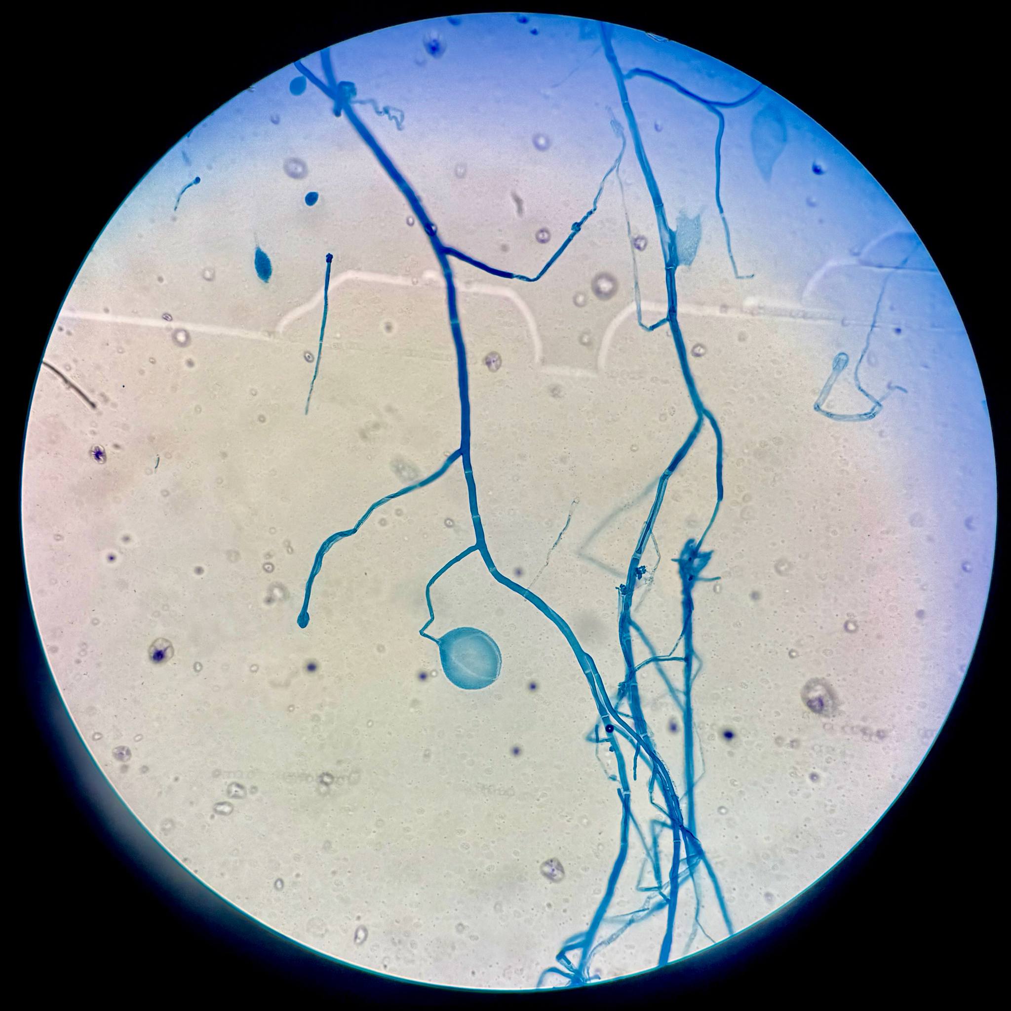 Macrophomina phaseolina