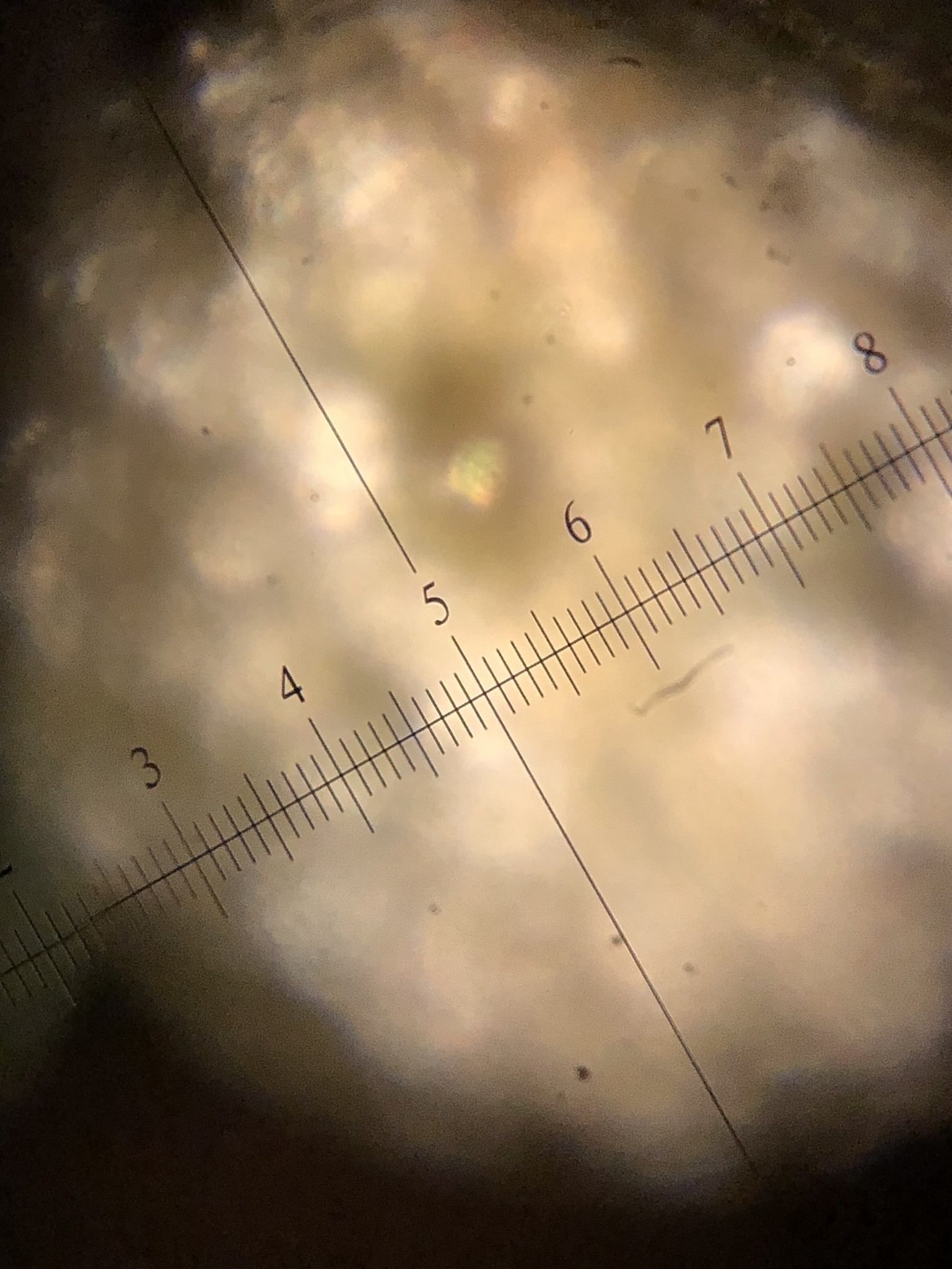 Peronospora belbahrii
