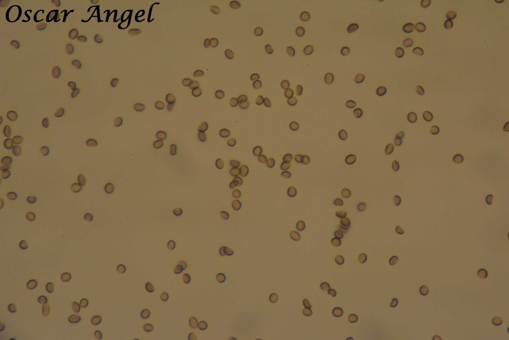 Ustilago tritici