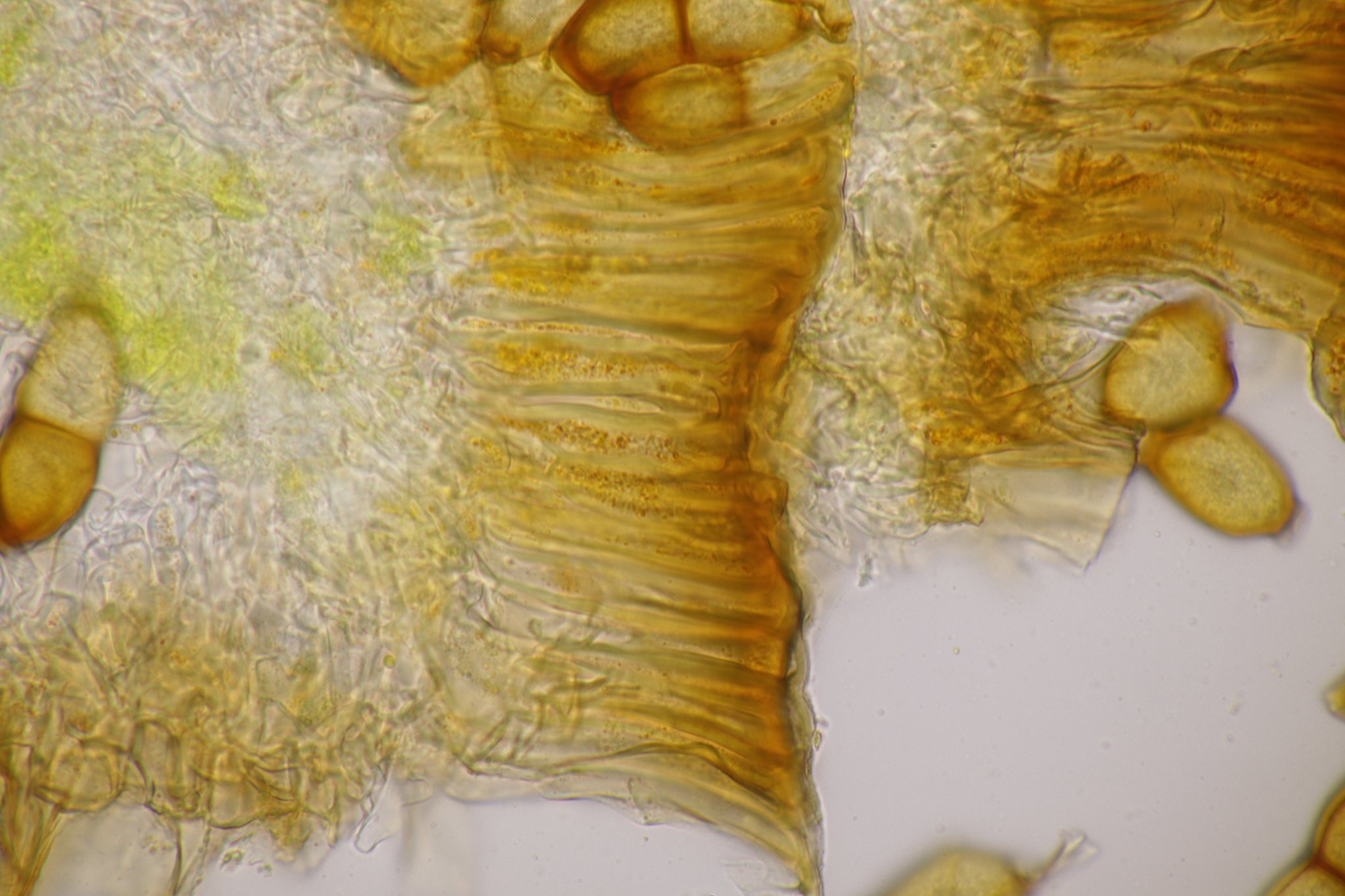 Puccinia allii