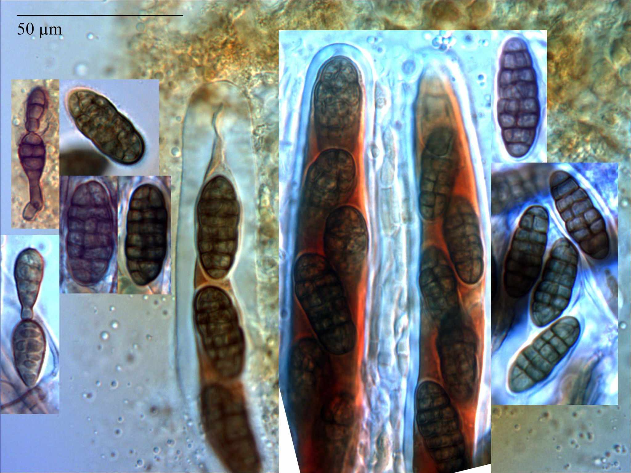Alternaria infectoria