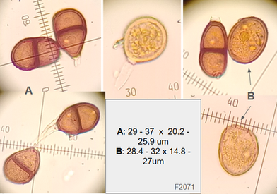 Puccinia hieracii
