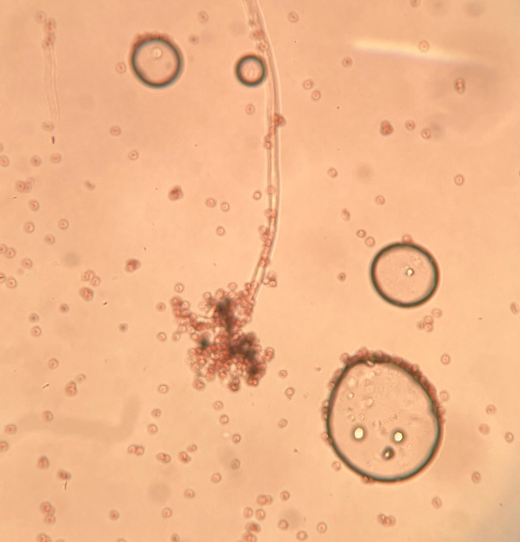Blakeslea trispora