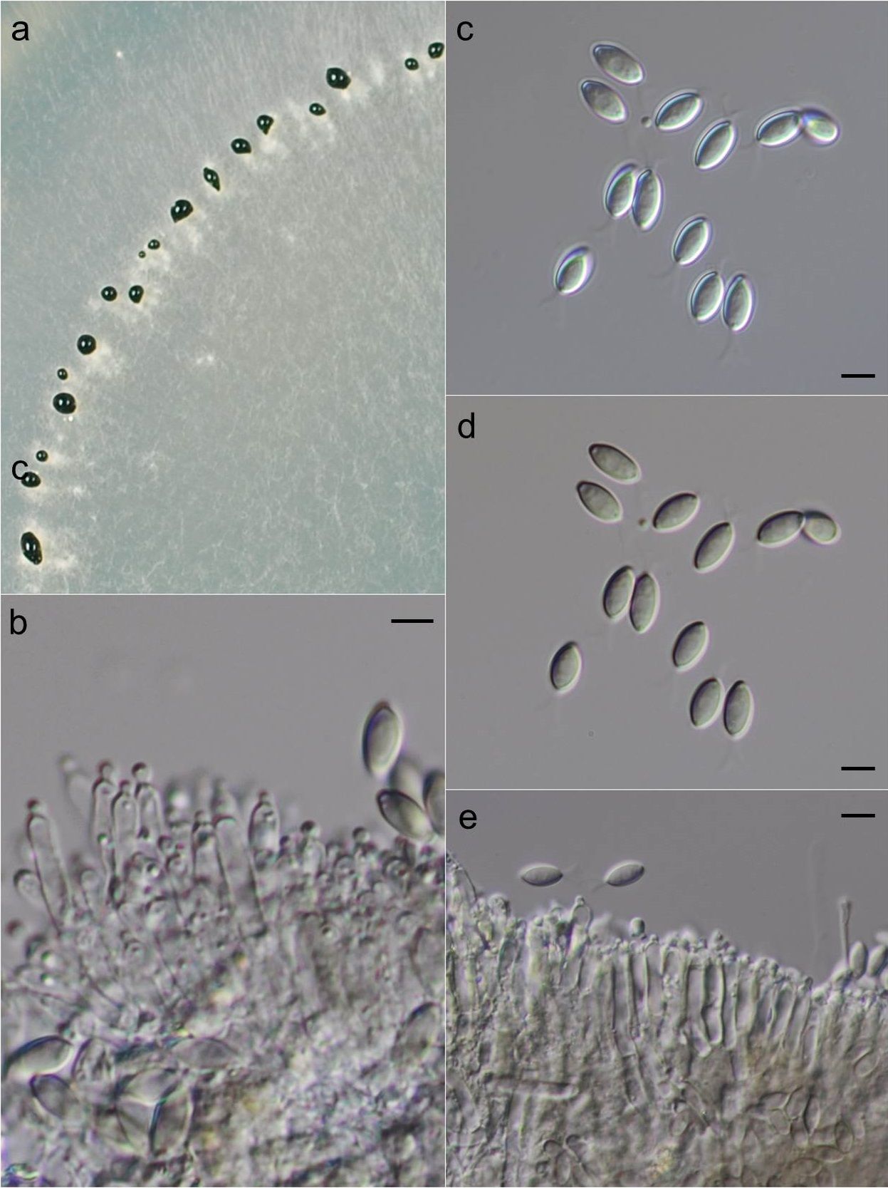 Albifimbria verrucaria
