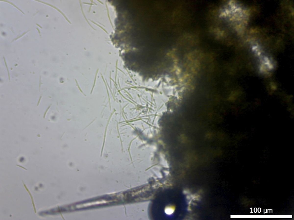 Septoria cucurbitacearum