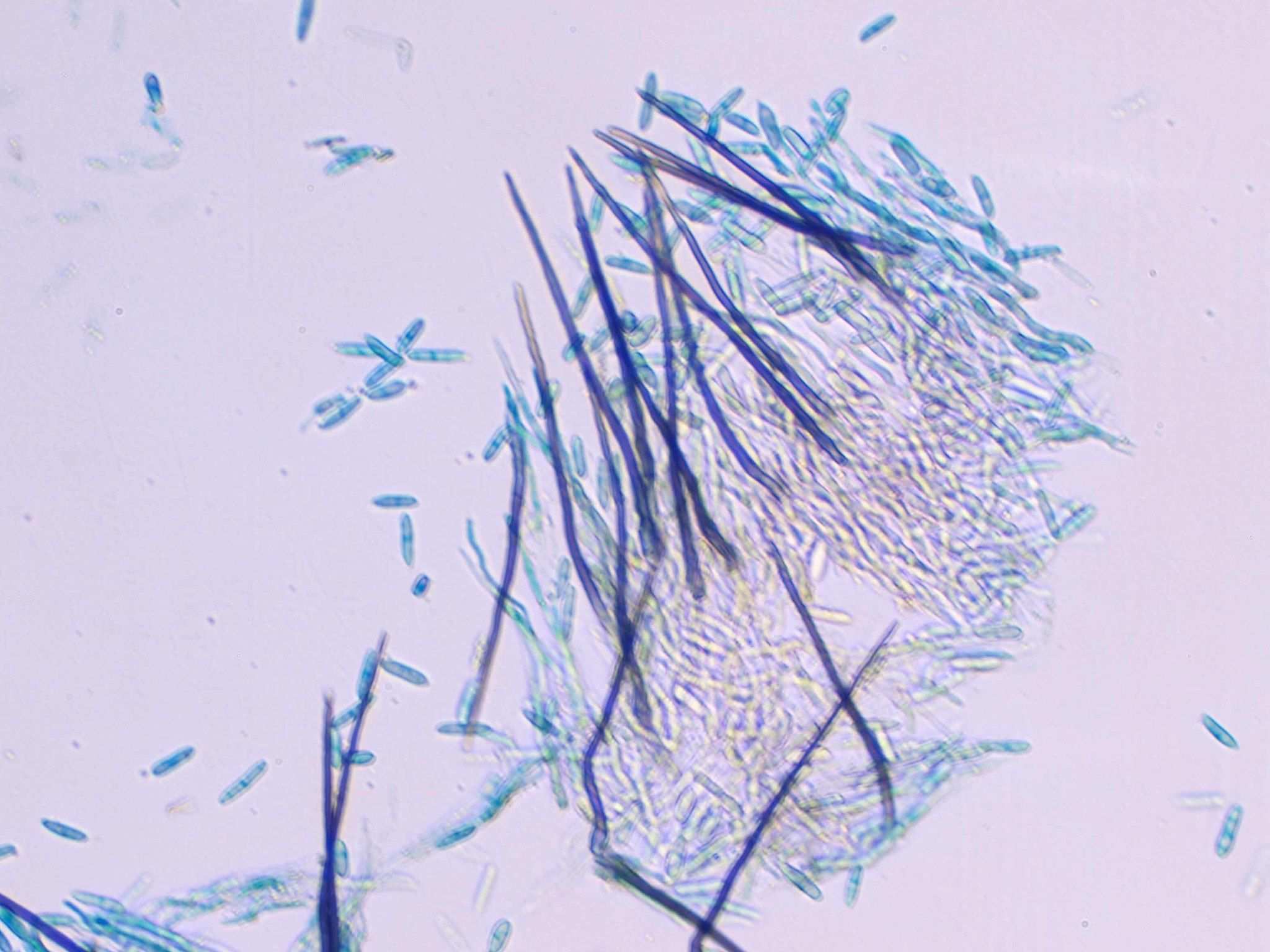 Colletotrichum higginsianum