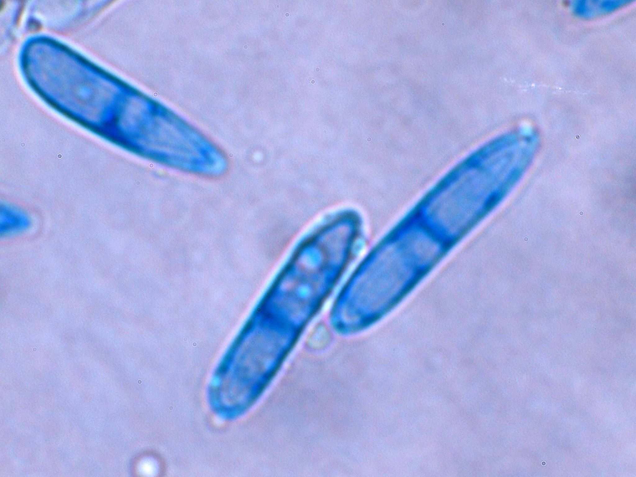 Colletotrichum higginsianum