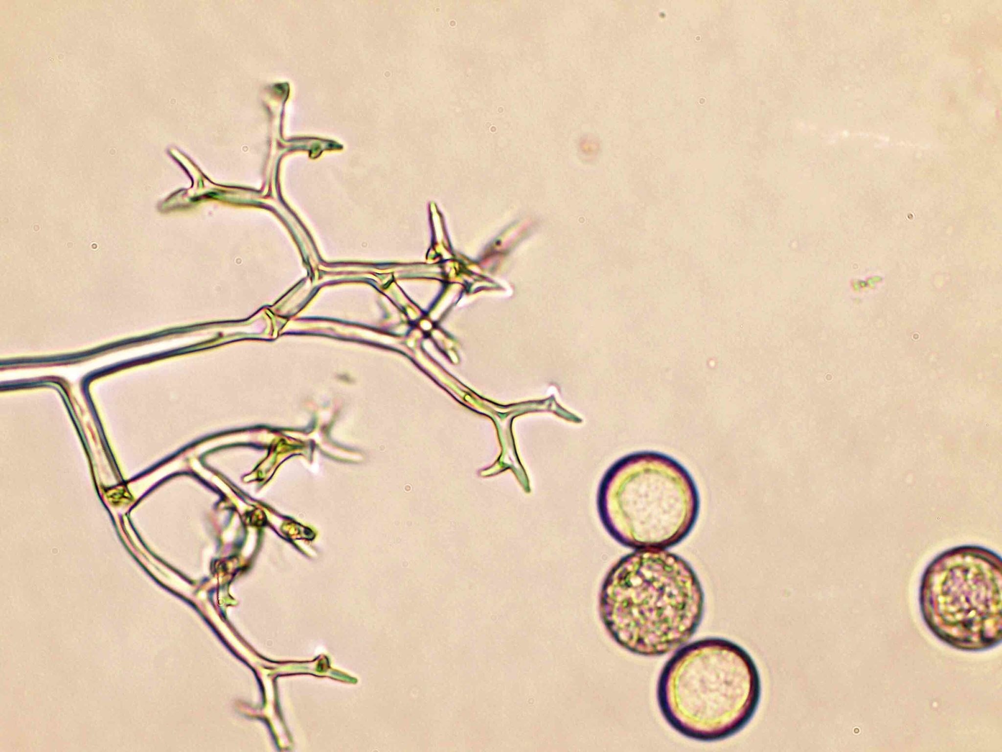 Peronospora manshurica