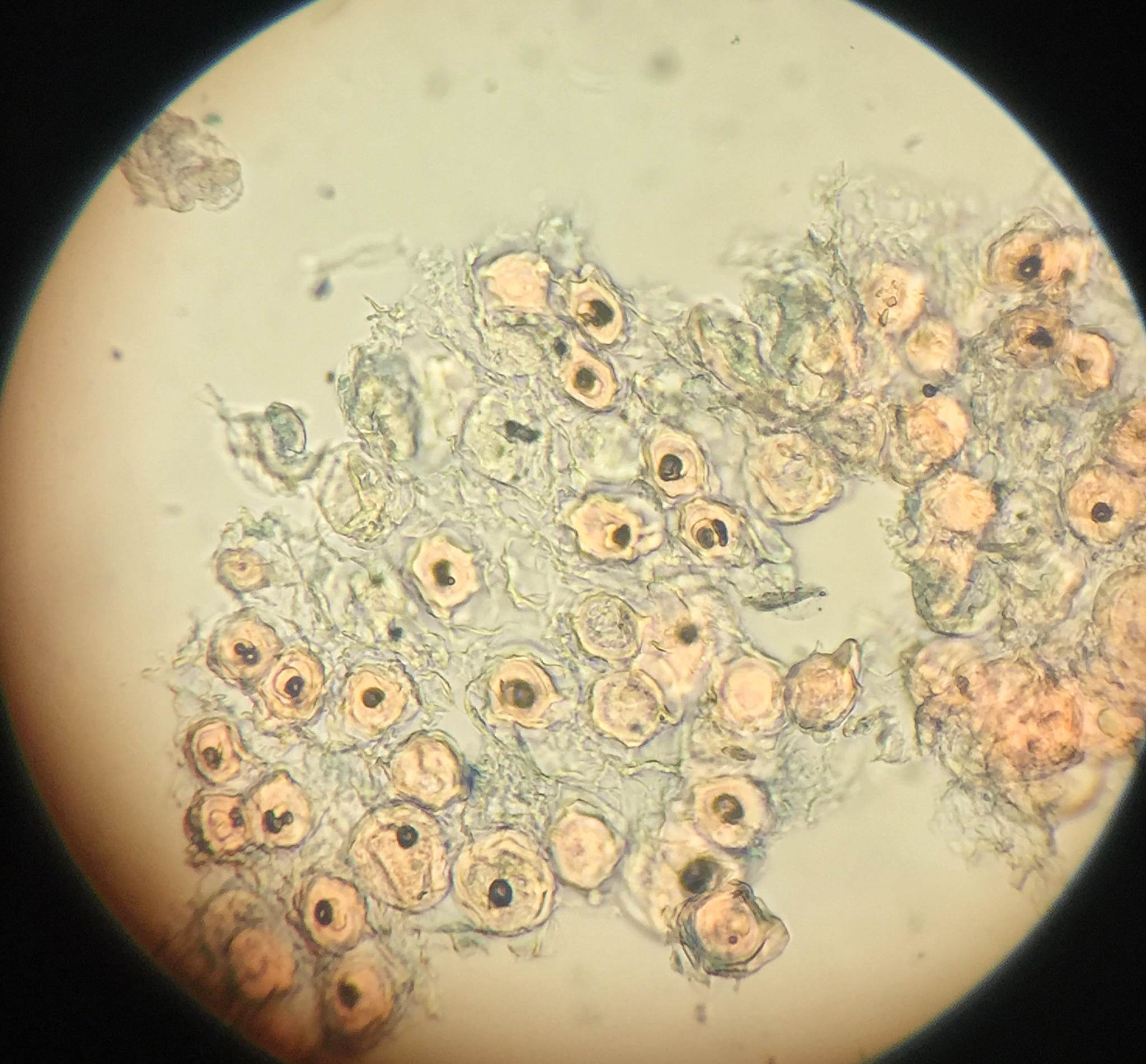 Peronospora manshurica