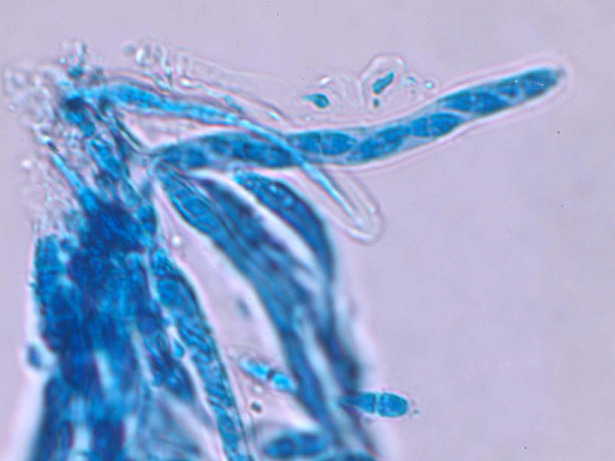 Stagonosporopsis cucurbitacearum