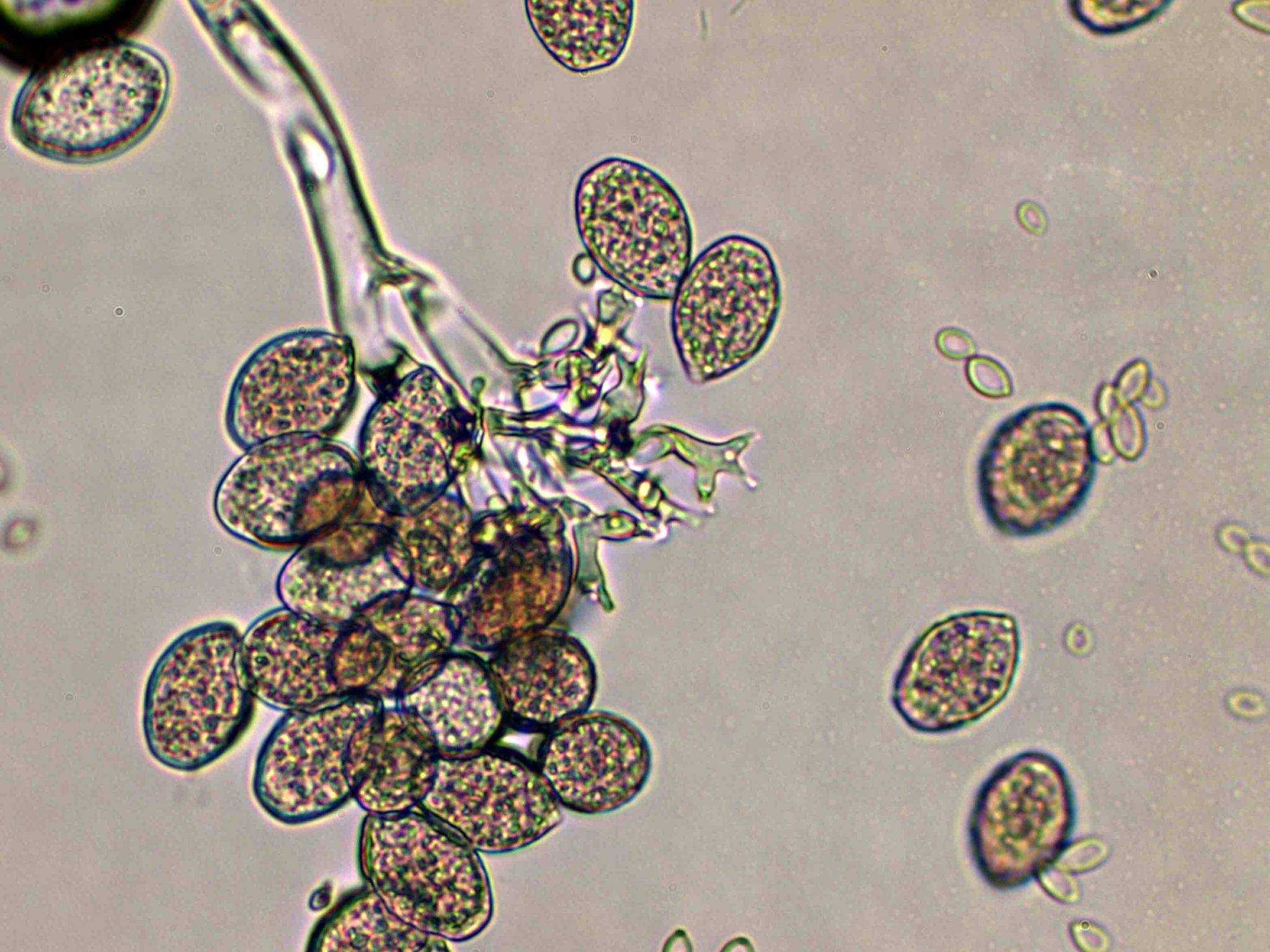Plasmopara viticola