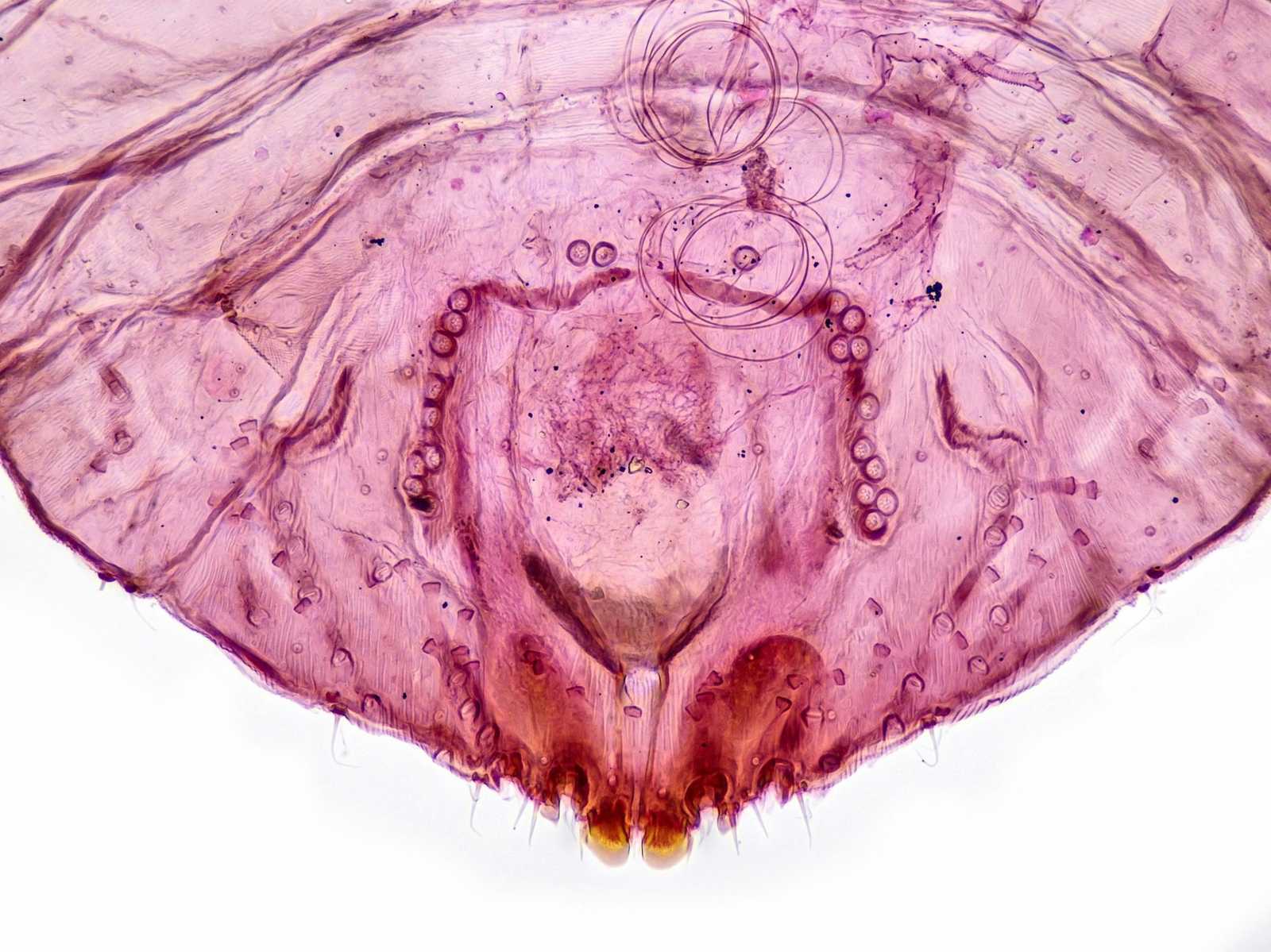 Diaspidiotus ostreaeformis