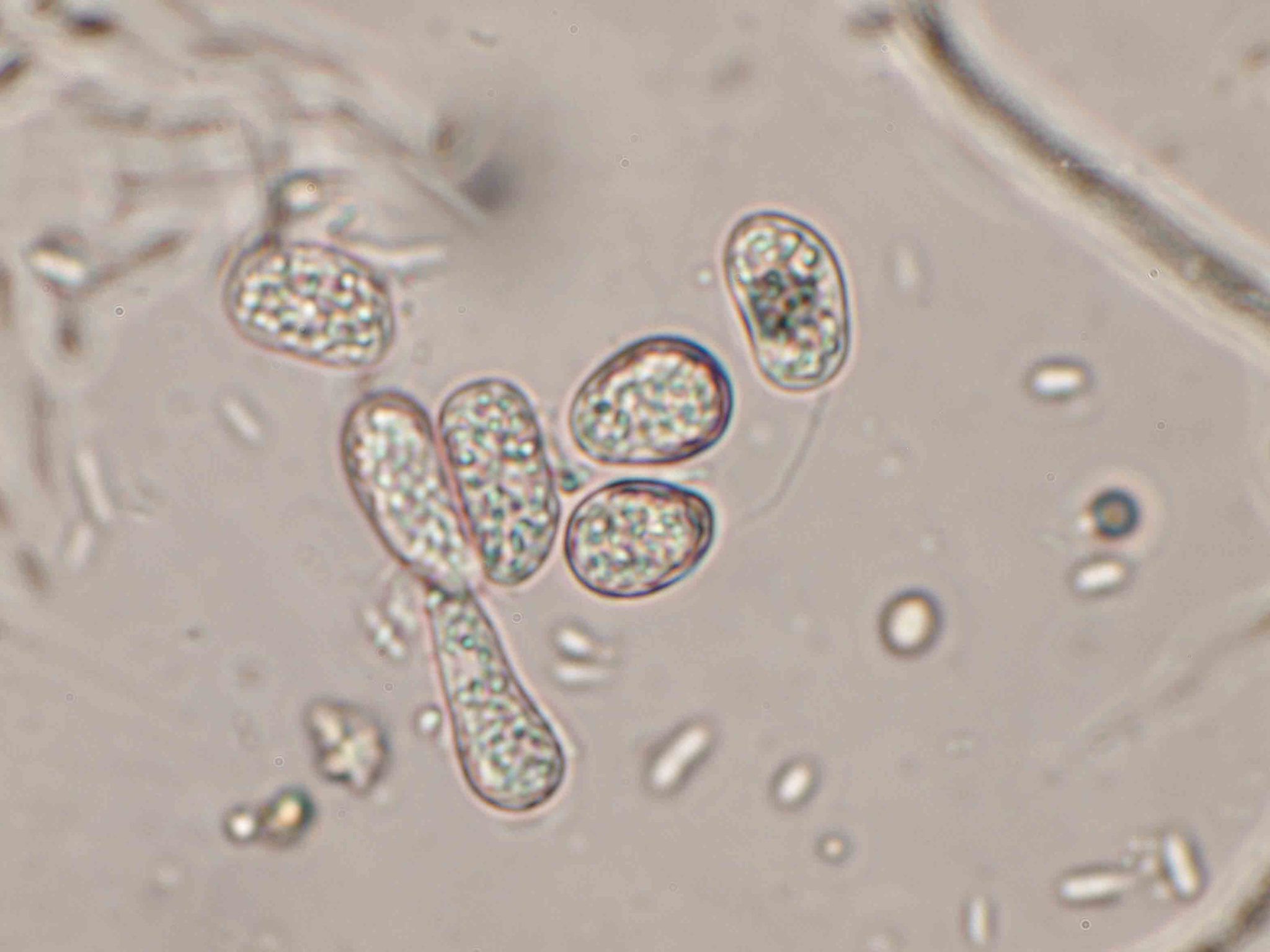 Phyllosticta musarum