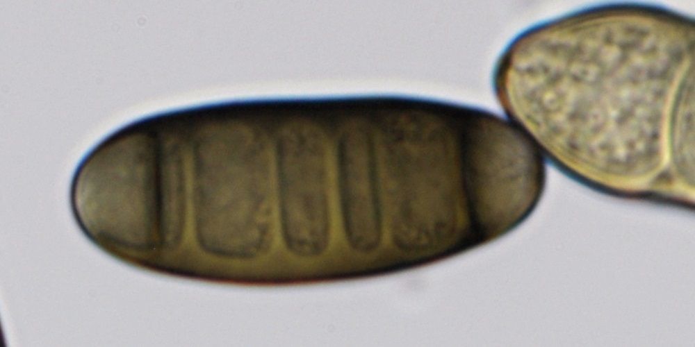 Bipolaris bicolor
