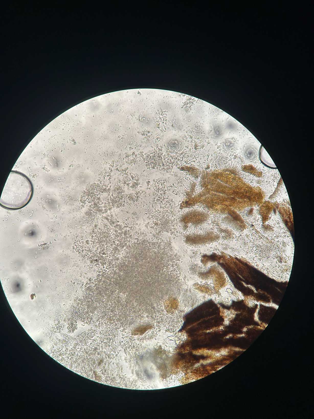 Diaporthe arctii