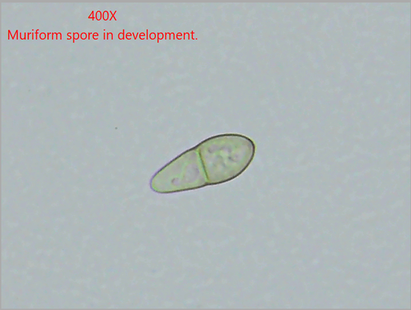 Alternaria tenuissima