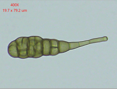 Alternaria tenuissima