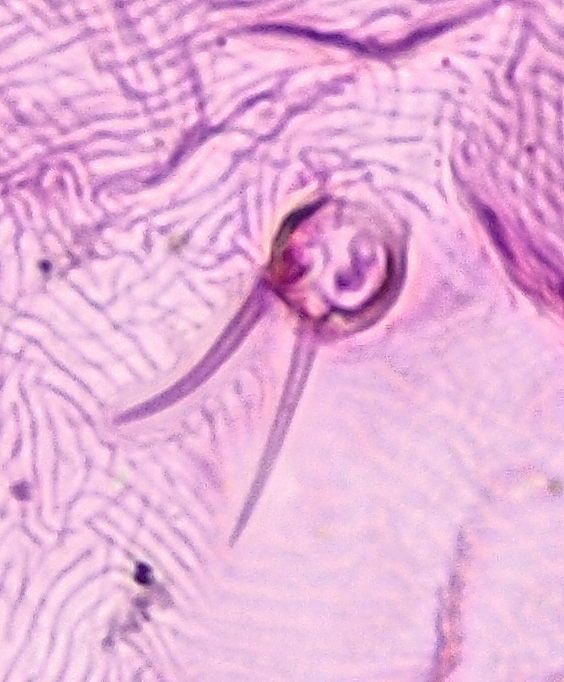 Lepidosaphes newsteadi