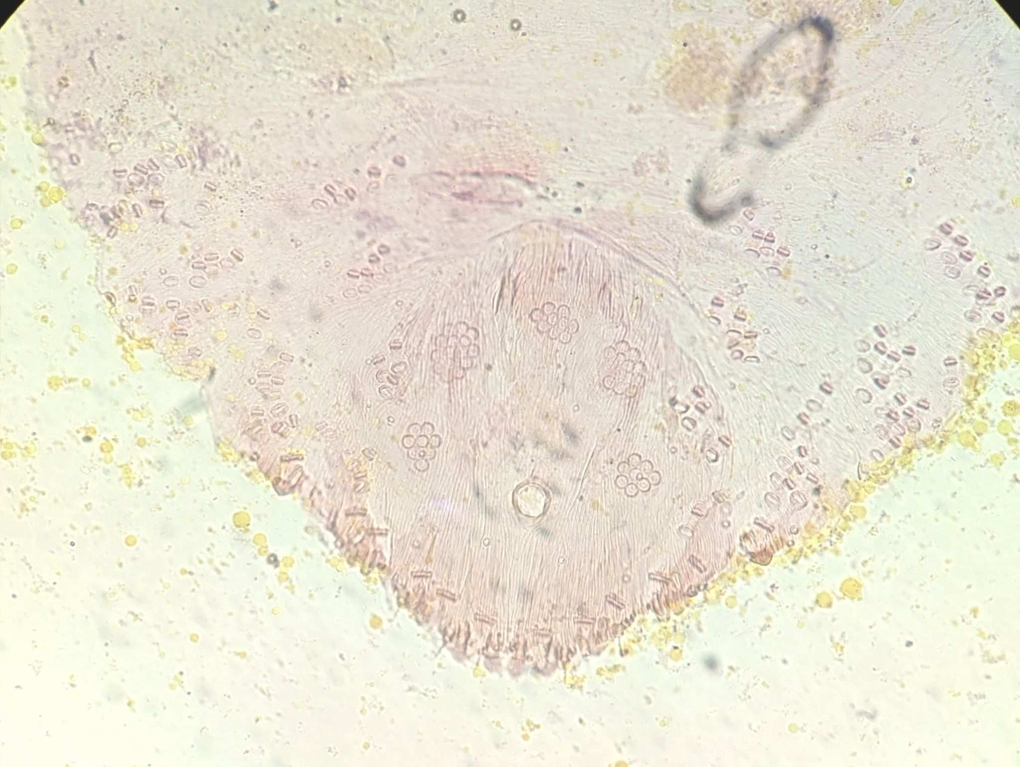 Carulaspis minima
