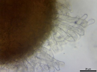 Erysiphe pisi