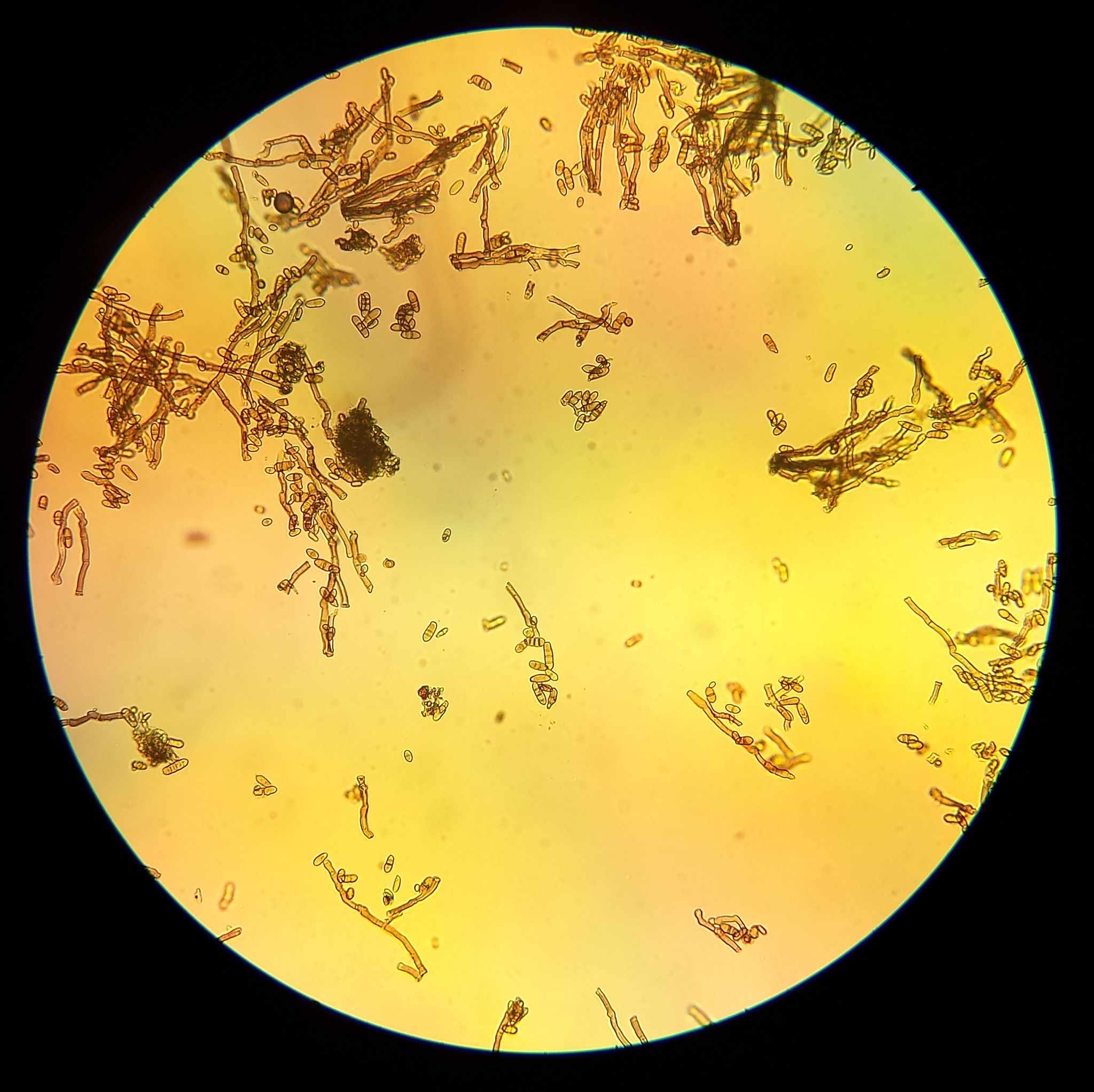Alternaria embellisia
