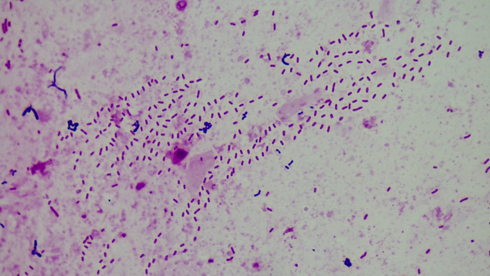 Pseudomonas fluorescens