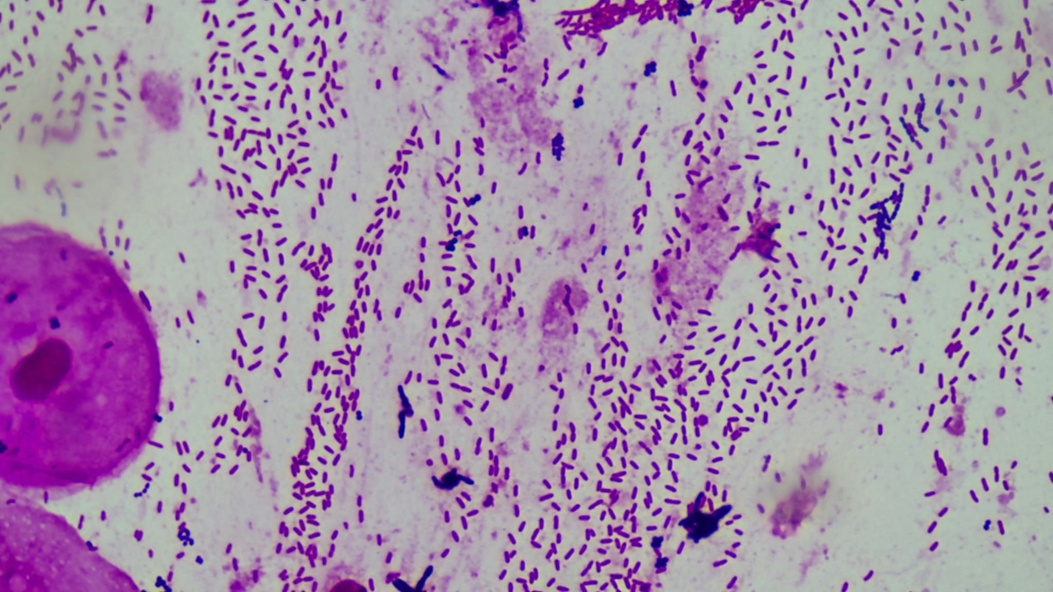 Pseudomonas fluorescens