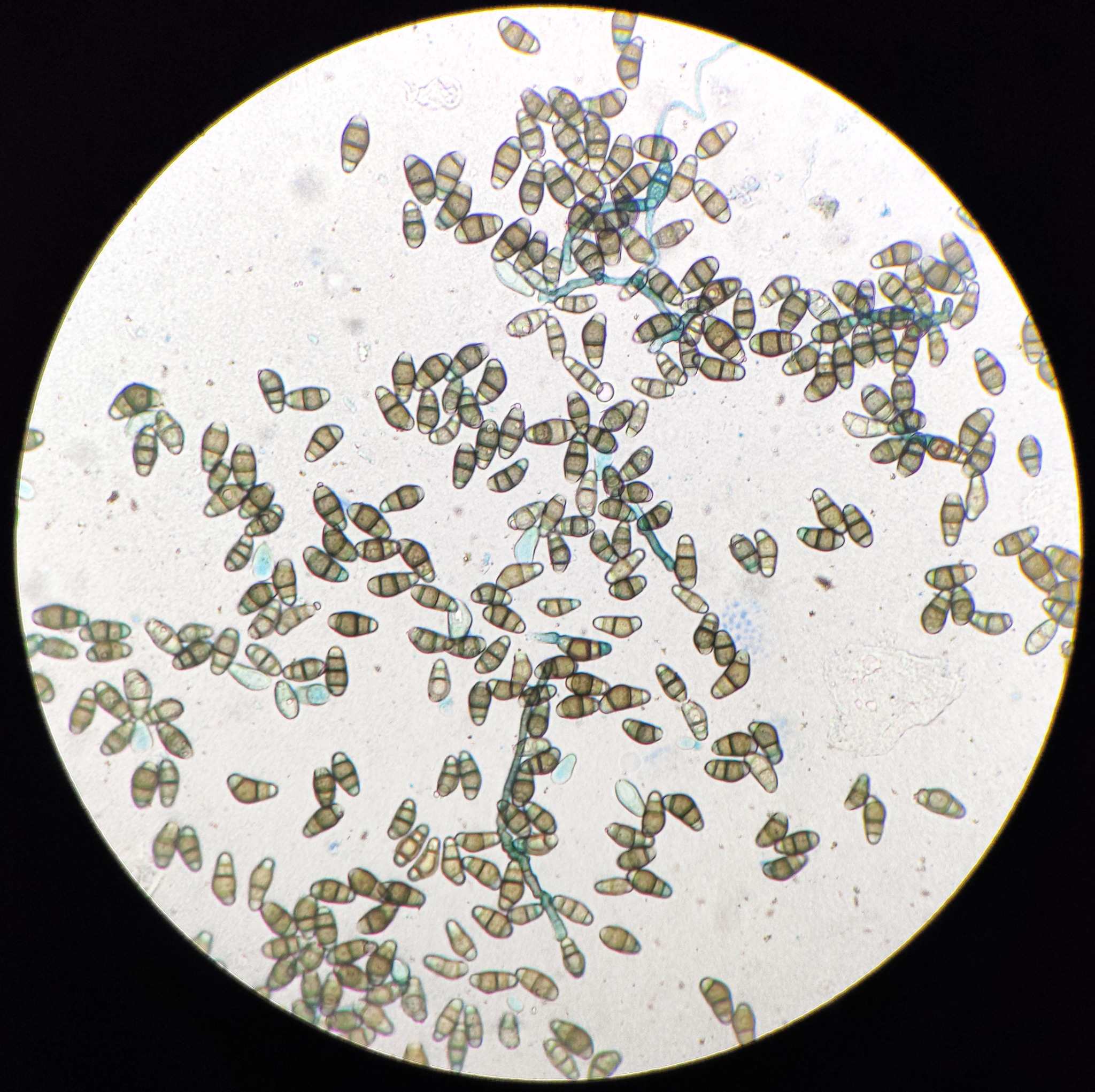 Curvularia lunata
