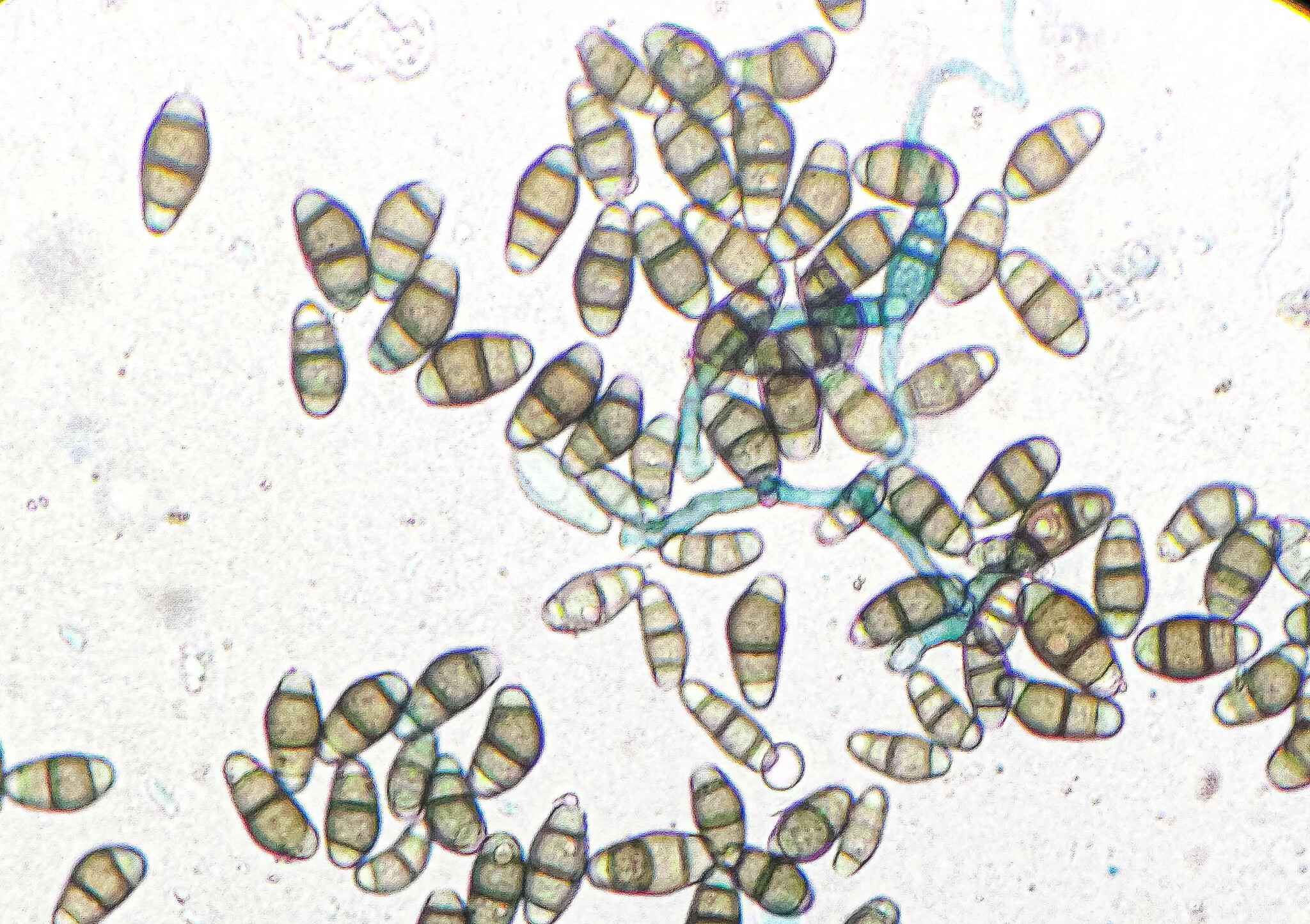 Curvularia lunata