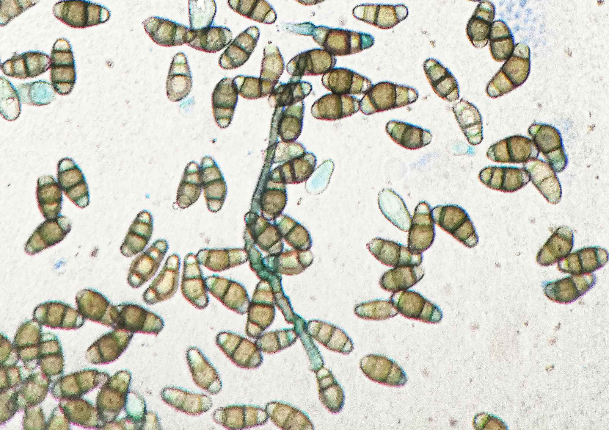 Curvularia lunata