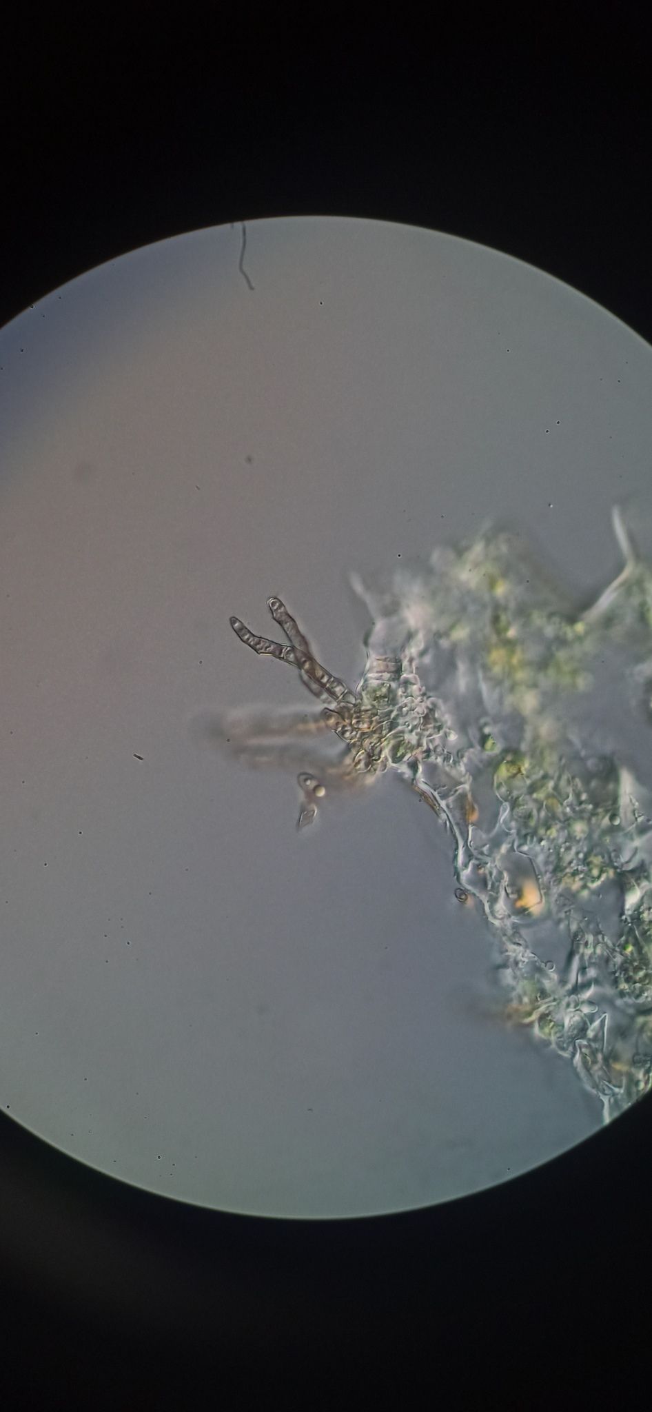 Pseudocercospora piperis