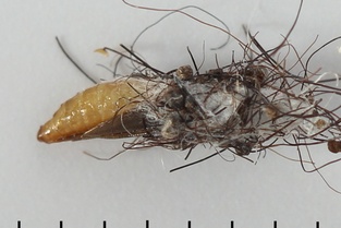 Tinea