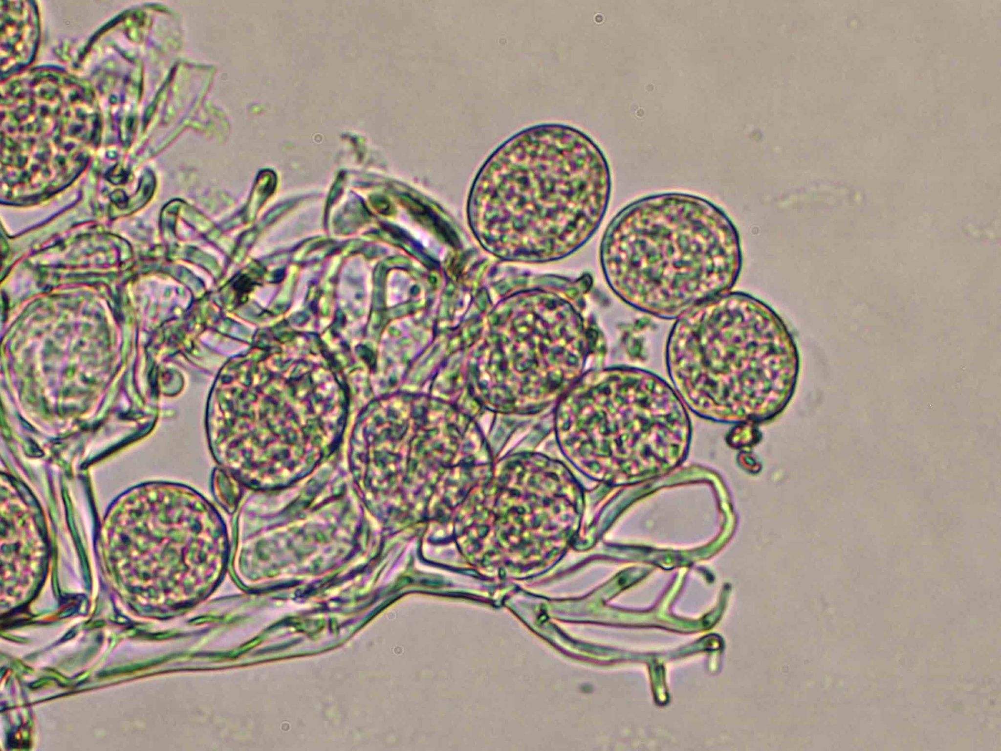Hyaloperonospora parasitica