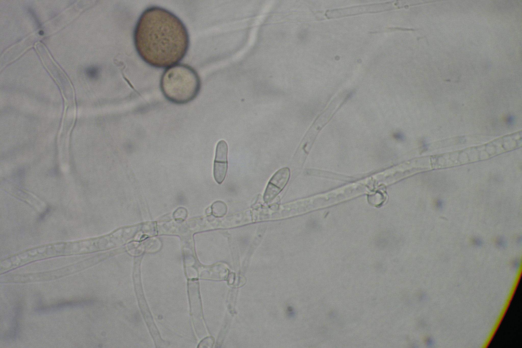 Harzia verrucosa