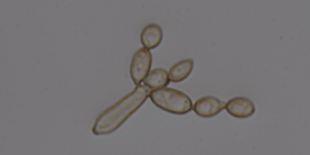 Cladosporium tenuissimum