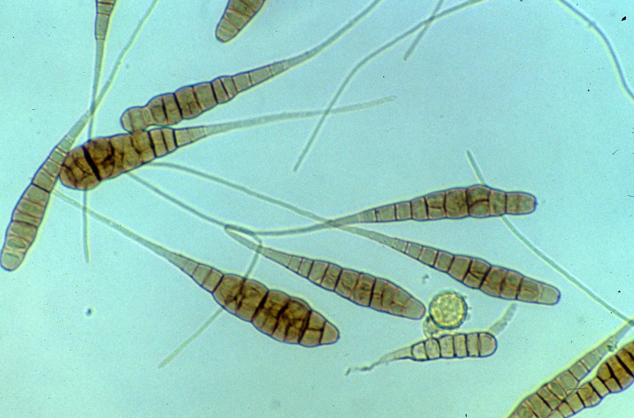 Alternaria porri