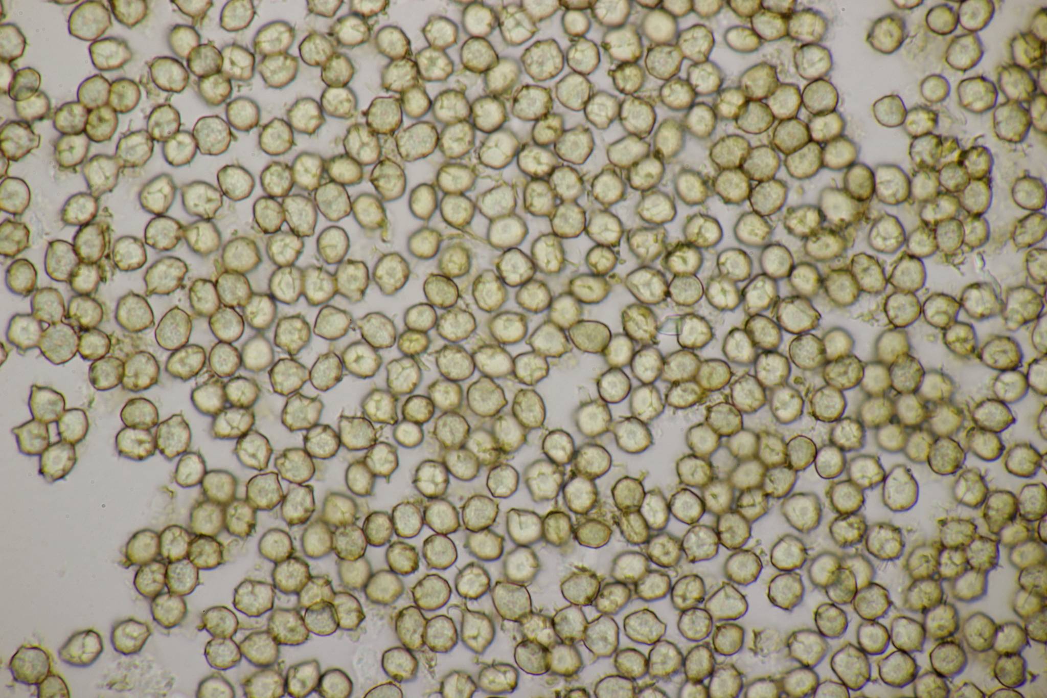 Moesziomyces bullatus