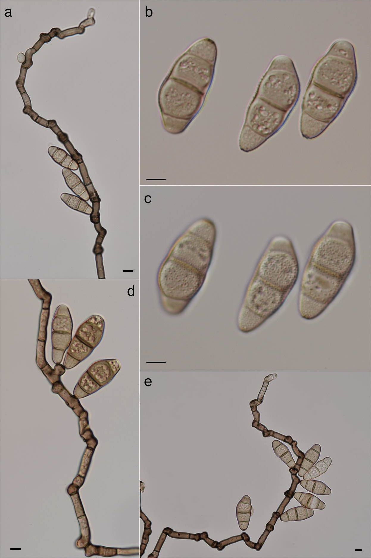 Curvularia verruculosa