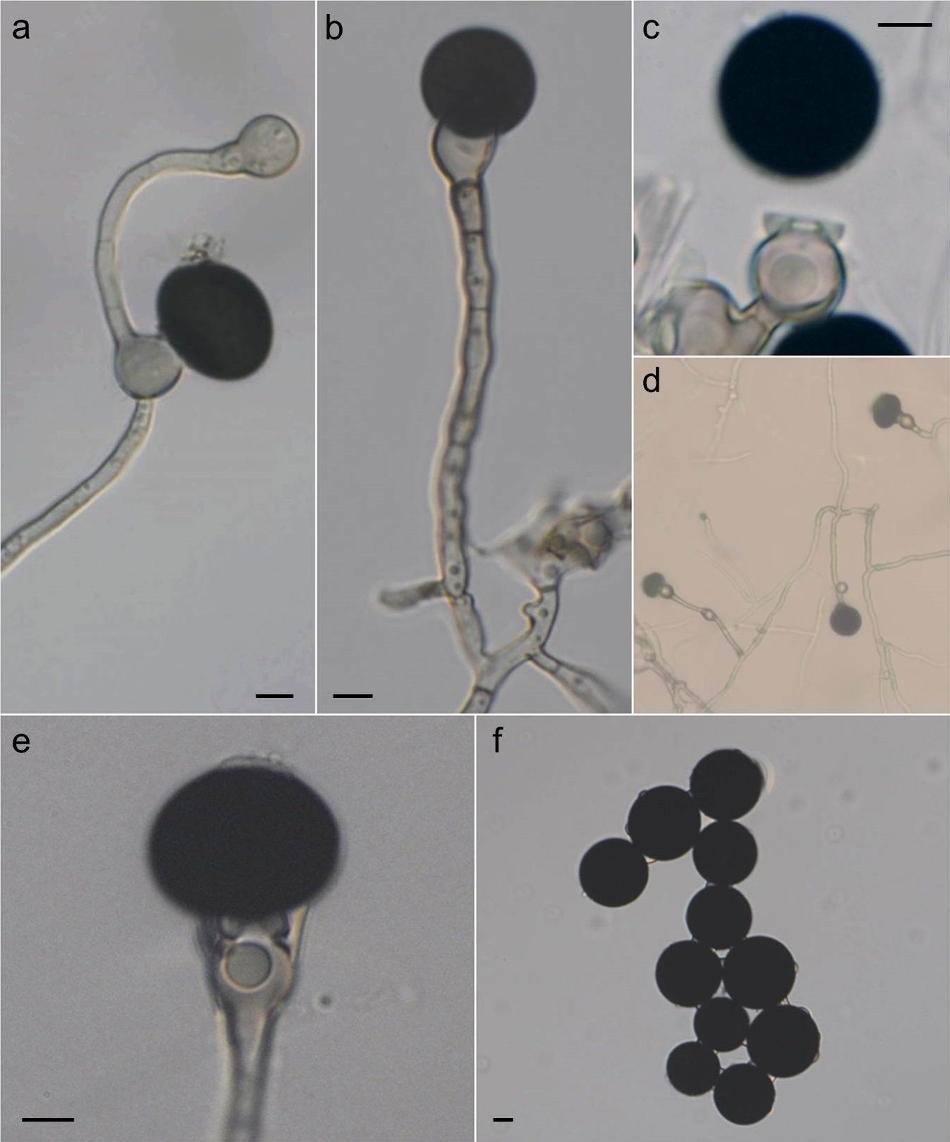 Nigrospora sphaerica