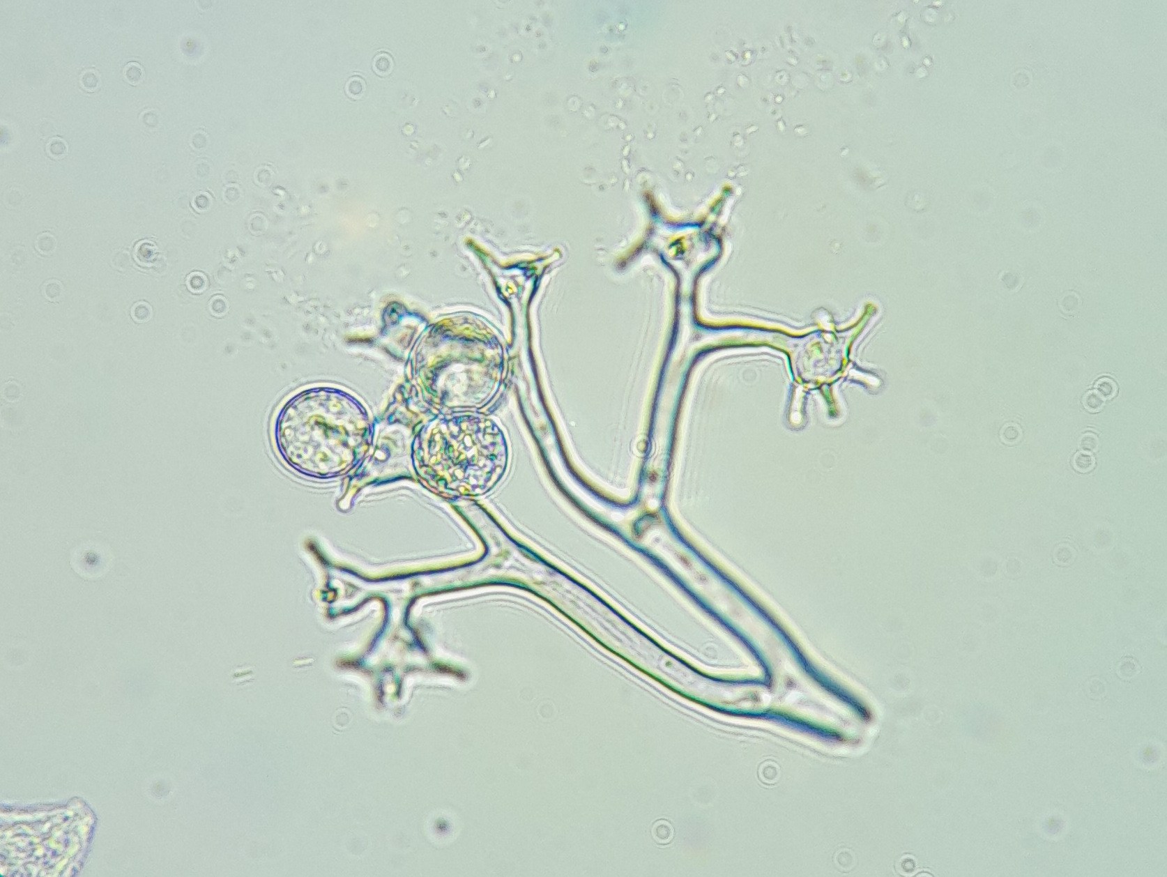 Bremia lactucae