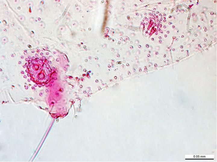 Pseudococcus jackbeardsleyi