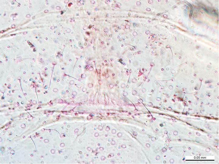 Pseudococcus jackbeardsleyi
