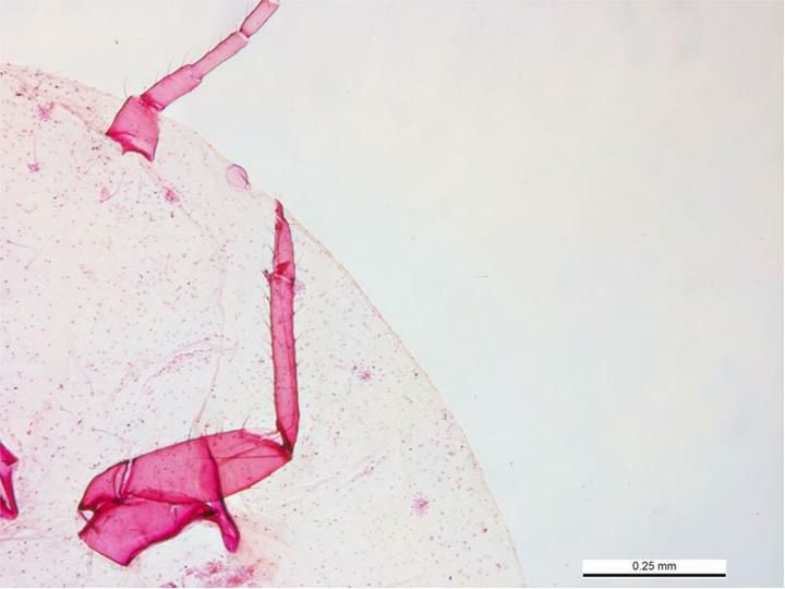 Pseudococcus jackbeardsleyi